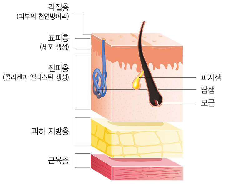가벼운 화상에 사용할 수 있는 일반의약품
