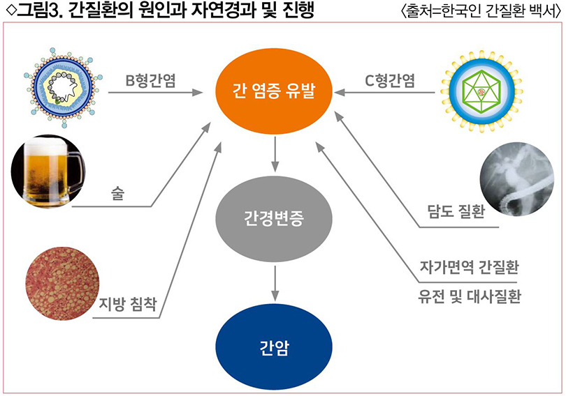 바이러스성 간염, 간질환 큰 비중 차지
